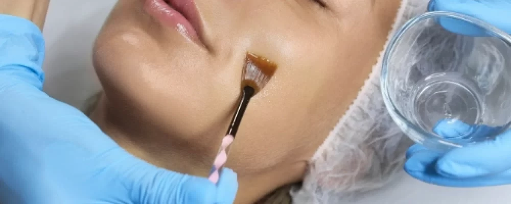 Chemical Peel in Dubai for Tan-Free Glow