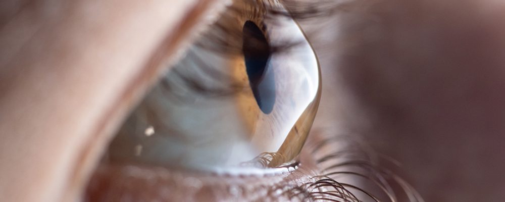 Barraquer Eye Hospital UAE Launches “We Care” Initiative To Raise Awareness About Keratoconus And Promote Early Detection