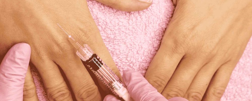 Common Myths About Hand Rejuvenation In Dubai
